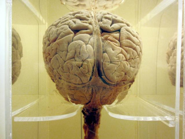 Brain (2)